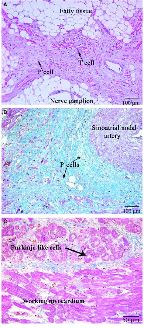 sa node cells are similar to nerve tissue